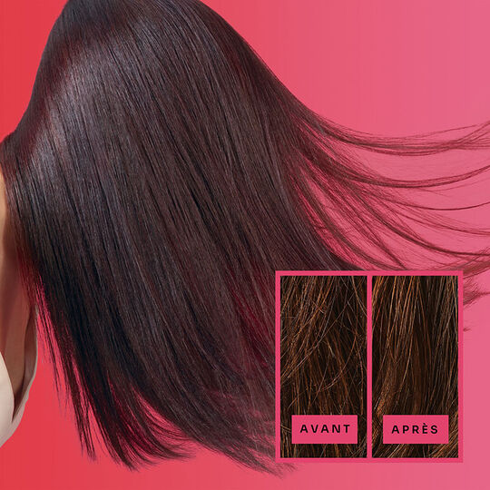 Trio reconstructeur renforçateur R-Two