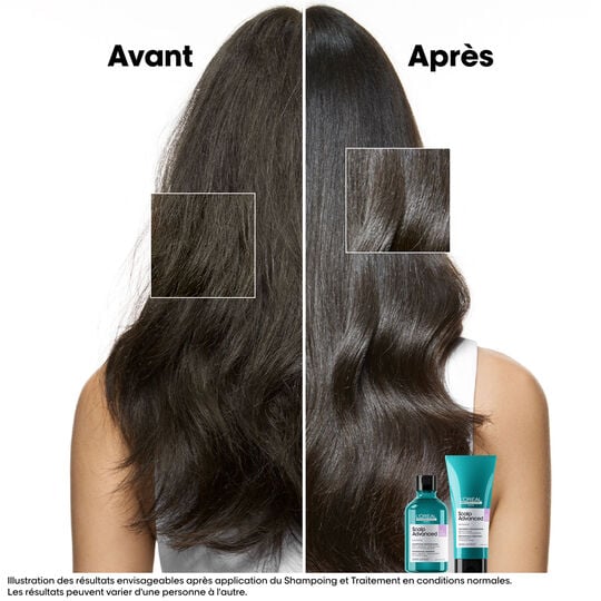 Shampooing dermo-r&eacute;gulateur anti-inconfort Scalp Advanced 1500ml