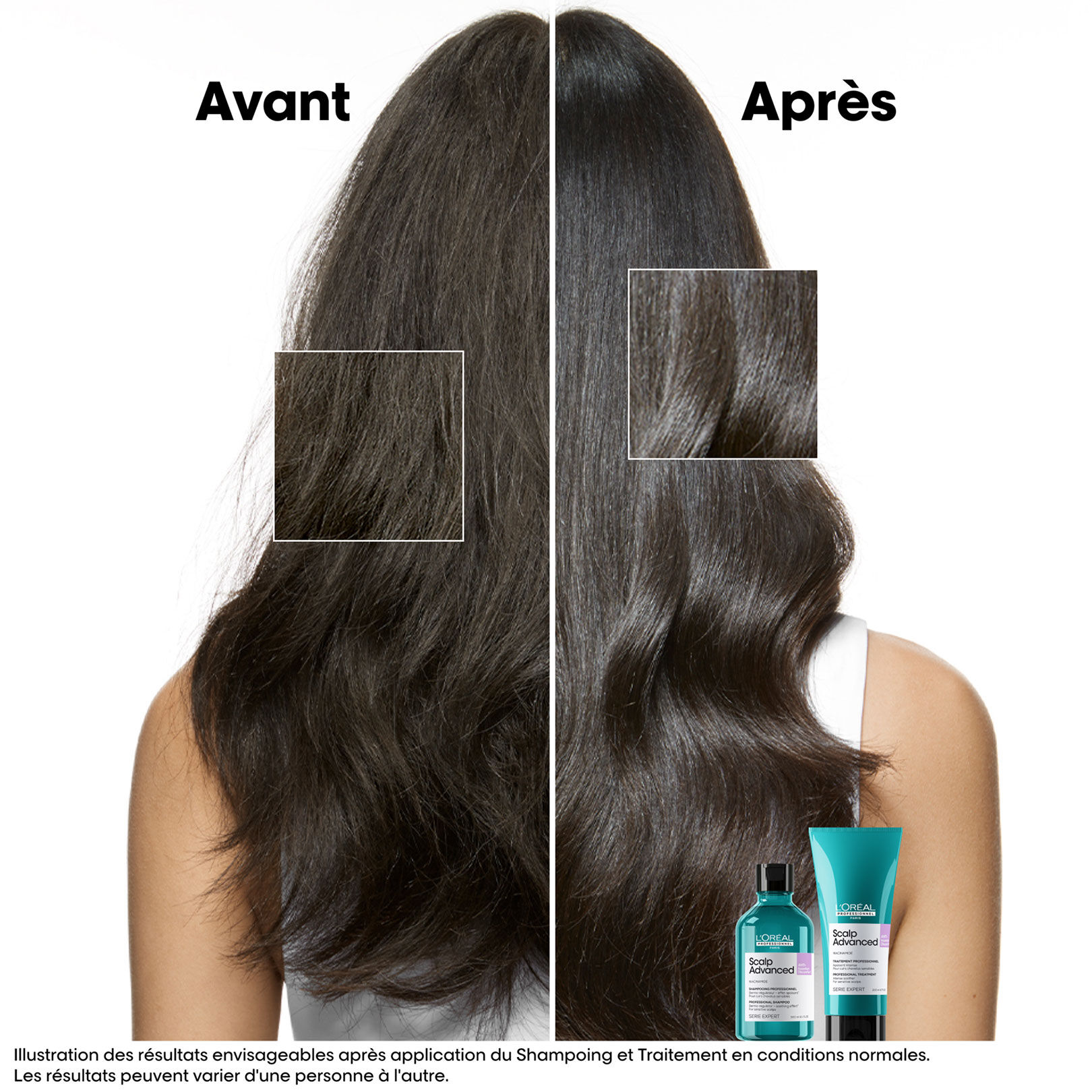 Shampooing dermo-r&eacute;gulateur anti-inconfort Scalp Advanced 500ml