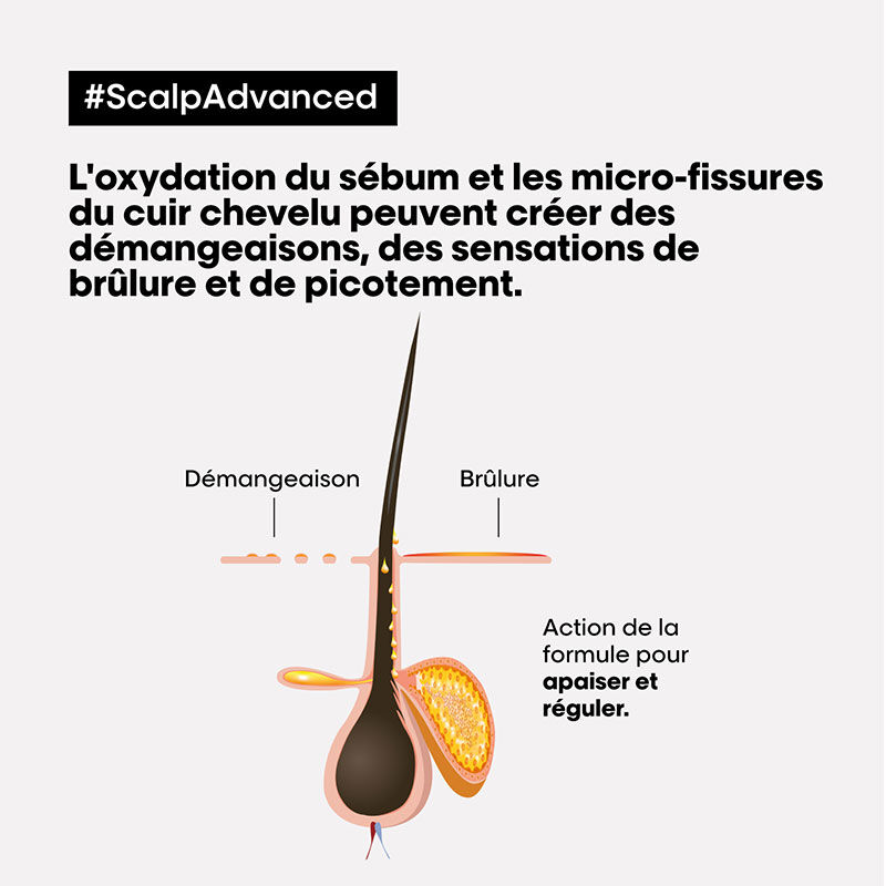 Routine anti-inconfort Scalp Advanced