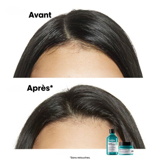 Shampooing dermo-purifiant anti-gras Scalp Advanced 300ml