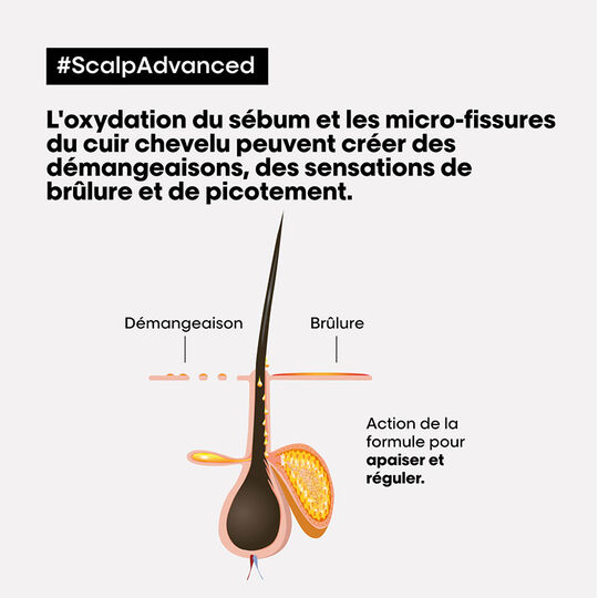 Traitement apaisant intense Scalp Advanced