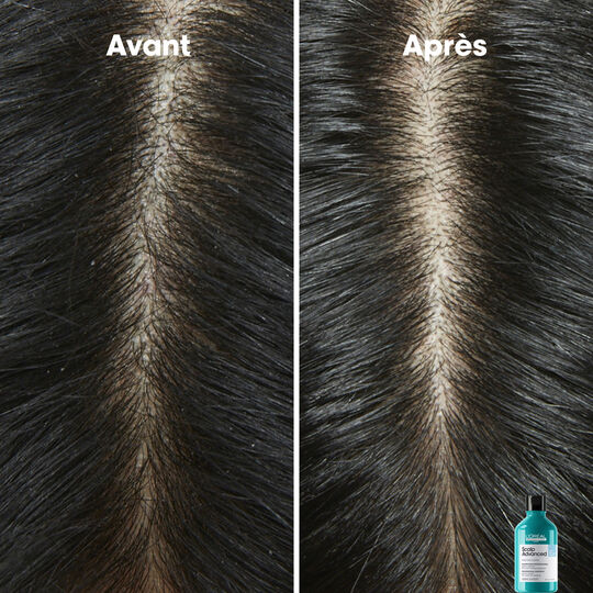 Shampooing dermo-clarifiant anti-pelliculaire Scalp Advanced 500ml