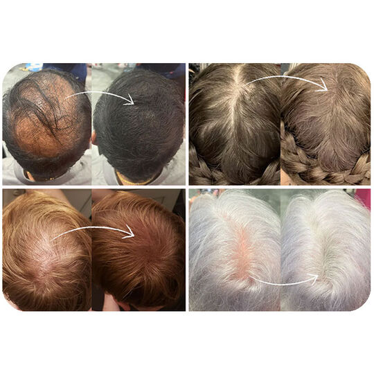 Fibres densifiantes pour cheveux châtain foncé