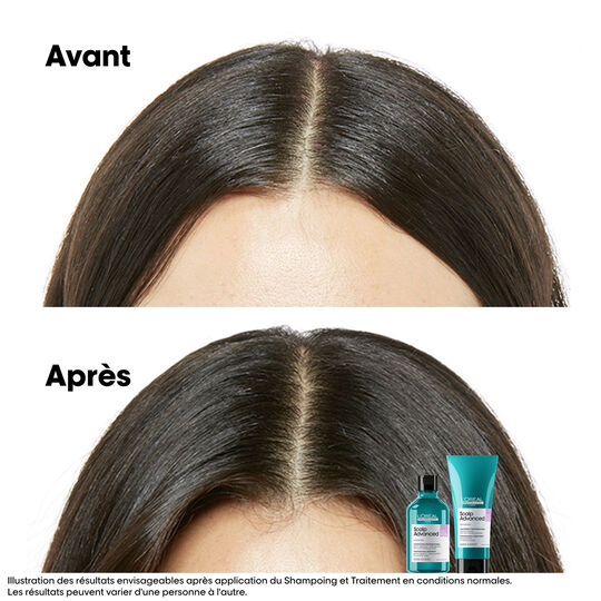 Shampooing dermo-r&eacute;gulateur anti-inconfort Scalp Advanced 500ml