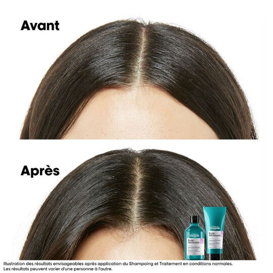 Shampooing dermo-régulateur anti-inconfort Scalp Advanced recharge 500ml