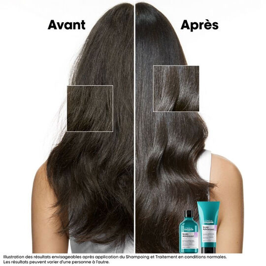 Shampooing dermo-régulateur anti-inconfort Scalp Advanced recharge 500ml