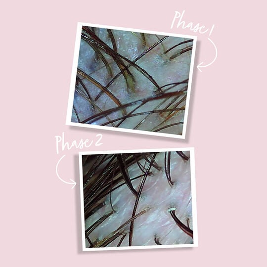 Huile détoxifiante Scalp Detox Oil Treatment