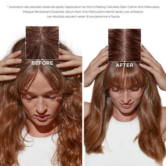 Bain cr&egrave;me anti-pelliculaire Symbiose